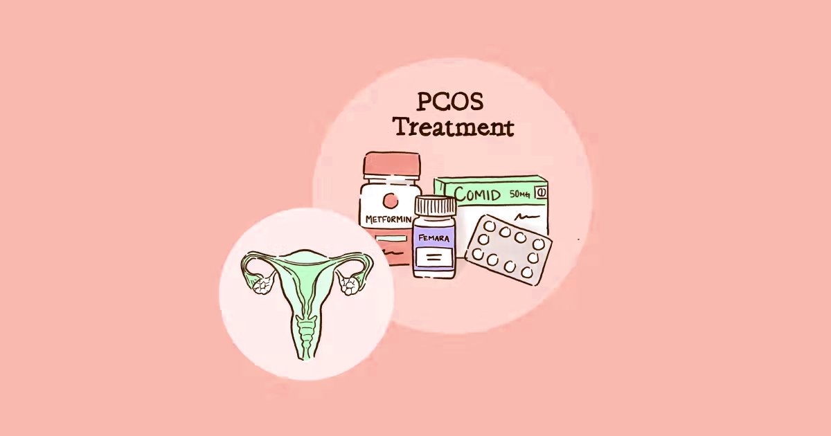 Ways To Treat PCOS in Women