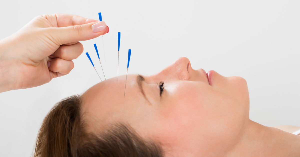 Alternative Treatments for for Migraine Patients