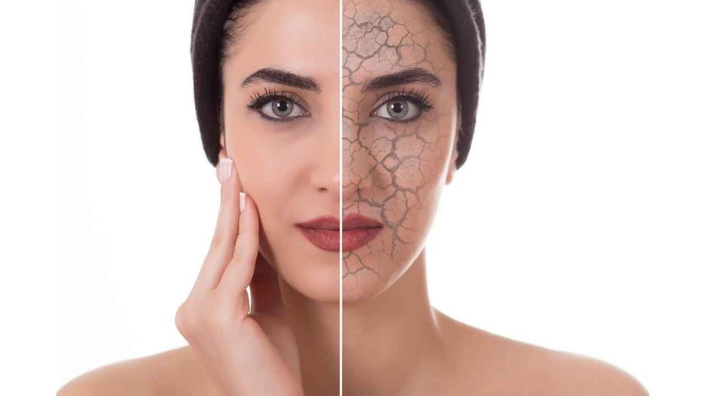 How To Treat Dry Skin On Face Follow These Tips Doctorsdubai 