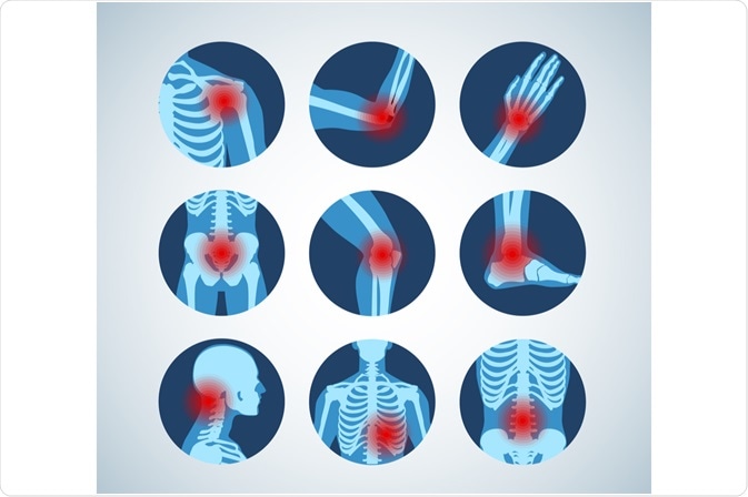 Conditions that Rheumatologist Treat