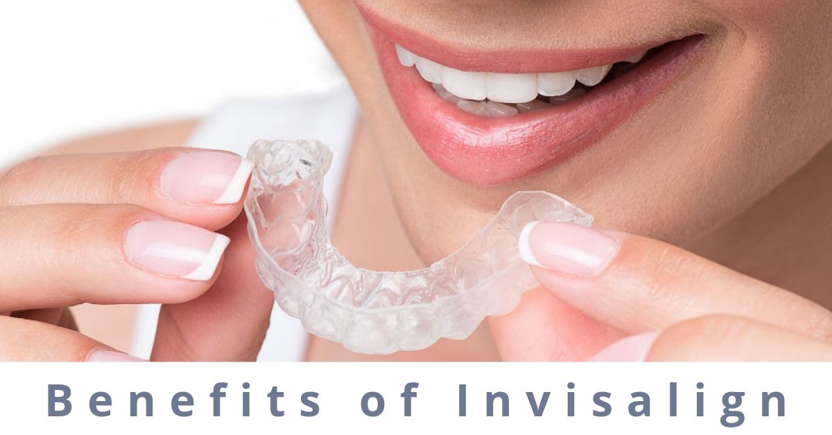 Invisalign in the girls hand telling Benefits of Invisalign