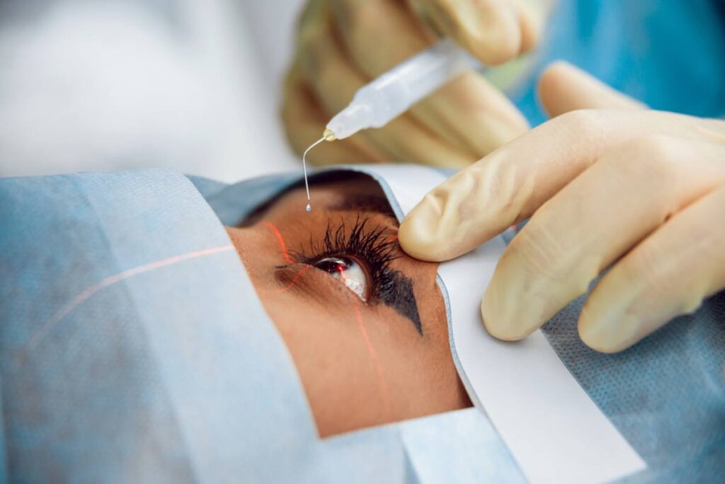 Best Laser Eye Surgery in Dubai